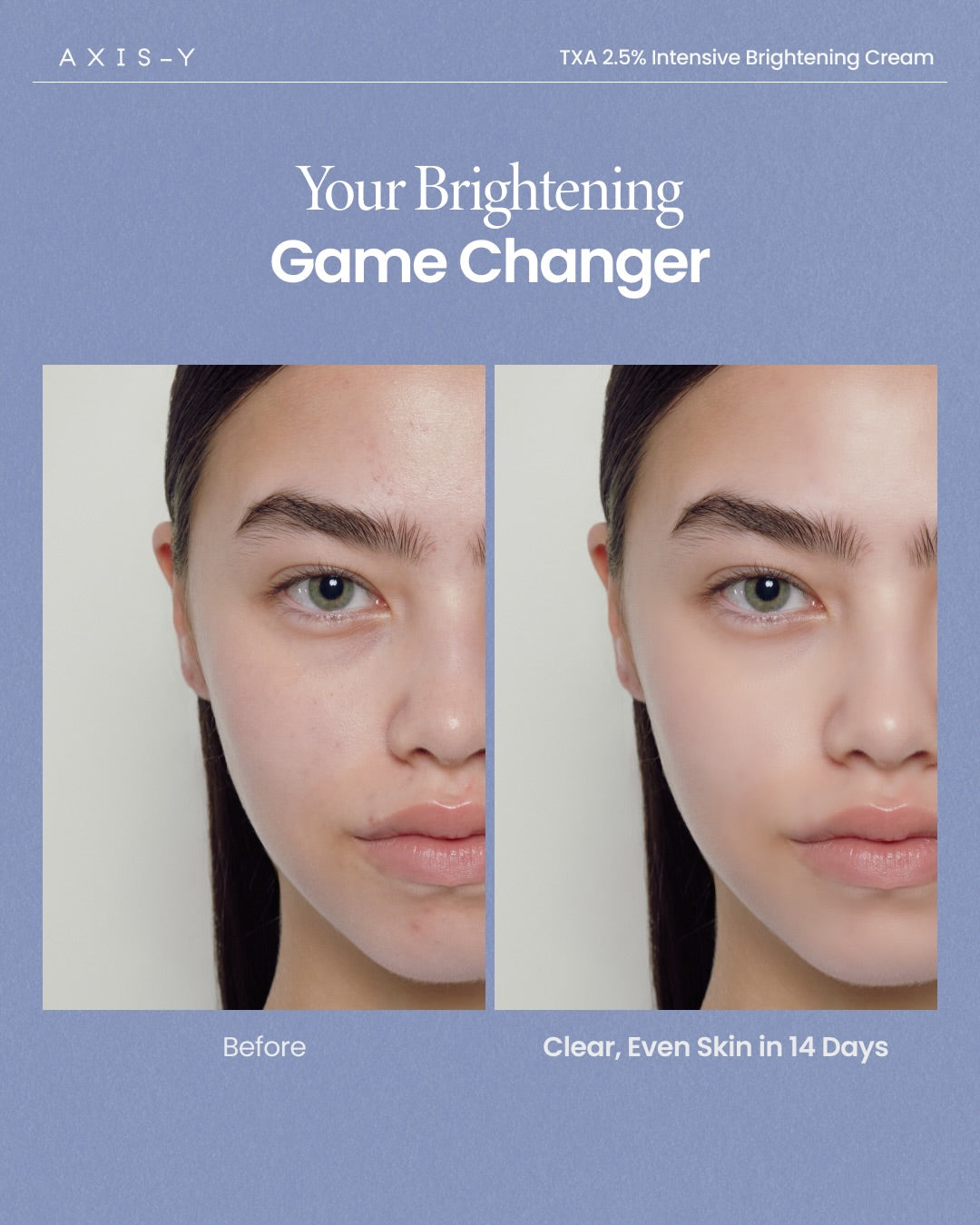 AXIS-Y TXA 2.5% Intensive Brightening Cream - 50ml
